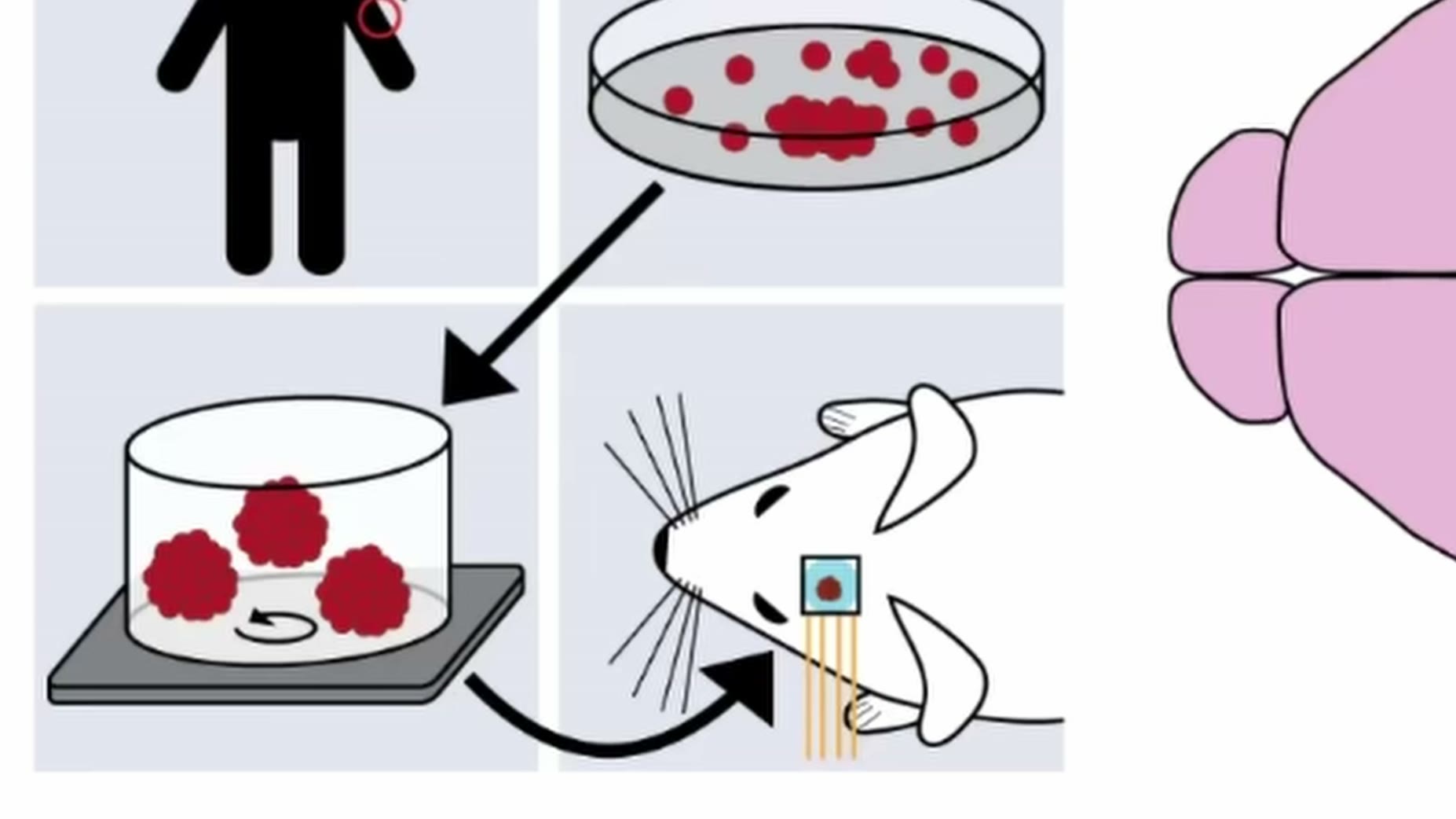 Study cited (PUBLISHED) [00:04:36]: Scientists transplanted four human cortical organoids into the vacant cavity, creati